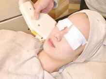 セラピエージ/IPLフォト美顔/顔脱毛