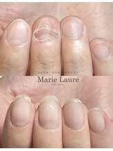 マリーロール 天王寺店(Marie Laure)/自爪育成/深爪矯正/ネイルケア