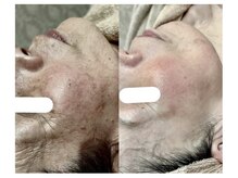 コスメ デ グレース イオンモール宮崎店の雰囲気(お客様ビフォーアフター)