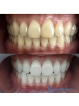 ラッシュラッシュ 八王子(LashRush)/歯科医提携ホワイトニング！