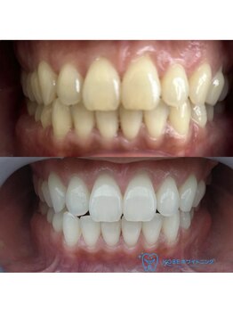 ラッシュラッシュ 八王子(LashRush)/歯科医提携ホワイトニング！