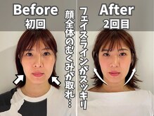 鍼灸整体院ユー(鍼灸整体院You...)