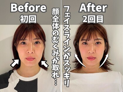 鍼灸整体院ユー(鍼灸整体院You...)の写真