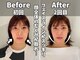 鍼灸整体院ユー(鍼灸整体院You...)の写真