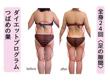 全身２４回コース【くびれ美・足に隙間】山科★本格痩身
