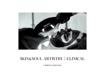 スキンアンドソウル アーティストリー クリニカル(Skin&SoulArtistry Clinical)の写真/毛穴×ニキビ×小顔|剥離なしブラックレーザー ピーリング ×IPL+SHR照射