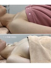 ビューティーサロン シンデレラ 心斎橋本店(Cinderella)/デコルテ下からふっくらバスト！