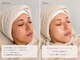 サロンドルル(salon de lulu.)の写真/【圧倒的ハリツヤ感】ピーリングと水光生美容液で満ちる潤い!内側から輝く水光肌を叶える☆
