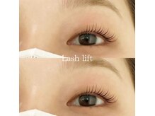 ビープラス(vi+)/ラッシュリフト