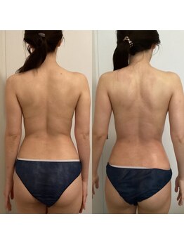 サンテ エ ボーテ 福岡博多店(Sante et Beaute)/ブライダルにも◎