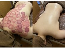 フェルヴィータ(Felvita)の雰囲気（気血水を巡らせ、土台を整える事でしっかりデトックスできる体に）