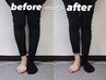 【X脚改善】片膝の歪みに悩みがある方向け60分