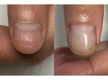 ナイズネイル(Ny's Nail)の雰囲気（深爪でお悩みもこんなに解決☆）