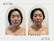 パリワール(pariwar)/インディバ＊ビフォーアフター