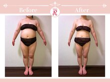 サロン アール(Salon R)/痩身施術×食事・インナーケア