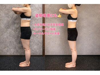 シャイン(SHINE)/20代女性ビフォーアフター