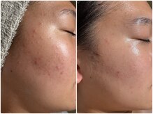 ウルソワン 都島店(/ulu soin)