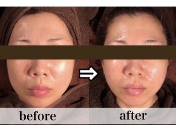 美容整体 ココ(COCO)/