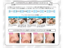 グリンダ キタイ(glinda kitai)/毛穴洗浄の施術の流れ