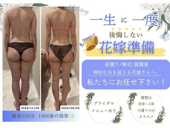 グレッシュ &nbsp;弘前店(Gresh)の写真/花嫁様お任せください♪ 挙式前の集中ケアで 当日いちばん輝くあなたへ導きます！