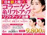 日本初上陸☆新世代コラーゲン糸リフト6本通常19,800円→初回9,800円