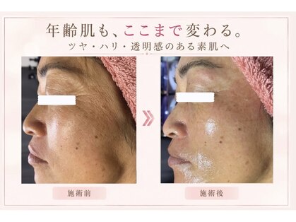 パタティパタタ(PatatiPatata)の写真