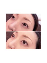 チャーミング(Charm Wink)/