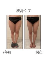 ファミーユ 新宿店/【インディバ痩身】