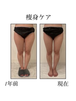 ファミーユ 新宿店/【インディバ痩身】