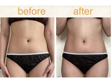 ラレコルト/ビフォーアフター