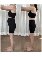 シュシュ上通/６１才　3ヶ月-8.1キロ