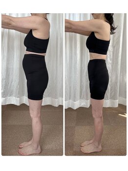 シュシュ上通/６１才　3ヶ月-8.1キロ