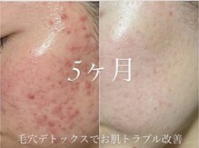 ファニービー 吹田店