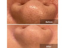 サロンドデュイ/1回施術/50代/四日市エステ