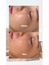 パール エビス(Pearl Ebisu)/ララピール