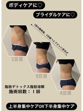 リセラージュ(Recellage)/