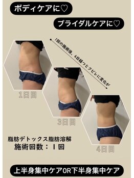 リセラージュ(Recellage)/