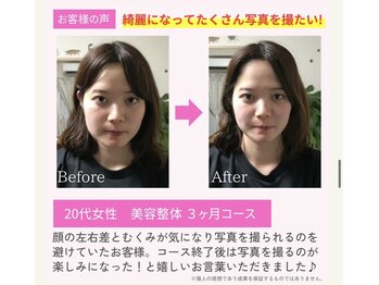 えのもと美容整体院/顔の歪み、むくみ、たるみ改善