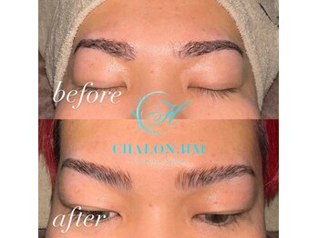 シャロンドットエイチエム(CHALON.HM)/アイブロウリフト