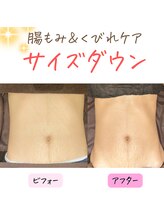 クリア リラクゼーションサロン(Clear)/ウエストラインスッキリ♪