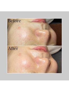 ブラックボックス(BLACK BOX)/日立市30代のお客様