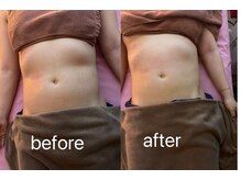 イーリバイブ/iNVYDOM MAX