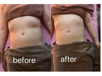 イーリバイブ/iNVYDOM MAX