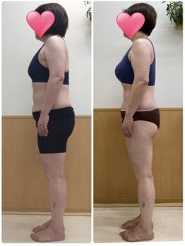 エステシオン(ESTESiON)/フォースカッター3ヵ月効果