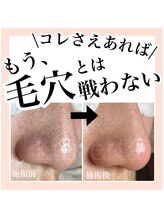 ルネッタ(Lunetta)/