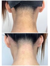 ホワイトワックス 京都四条烏丸(WHITE WAX)/うなじ脱毛♪