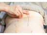 【ボディ鍼】腰痛に効果◎鍼の刺激で腰の辛さを緩和！¥4400