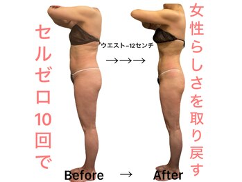 アールユー ギンザ(Ryou ginza)