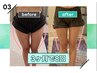 【あの頃の美脚を取り戻す】痩身スライドカッピング下半身40分7480円→3480円