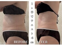 リアレント 高槻店(Lialent)/インディバ60分×6回【60代】